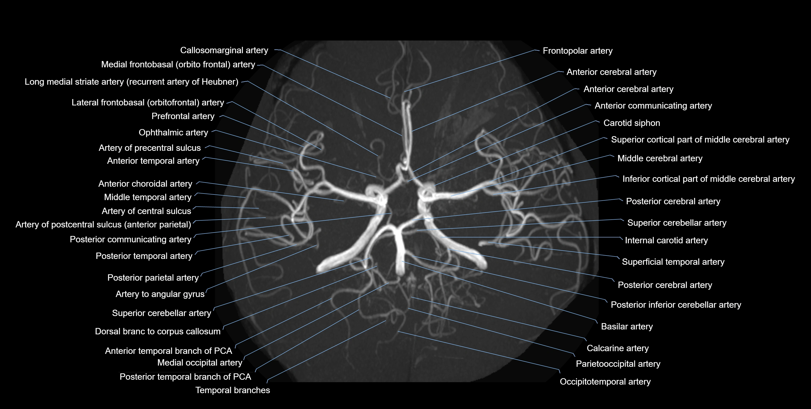 MRA brain axial MIP labelled  anatomy 3T MRI images -img-01021-00003.webp